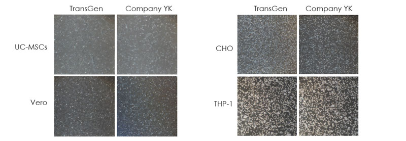 使用TransGen 凍存液和Company YK 無DMSO 無蛋白凍存液在-80℃凍存1 個月的多種細(xì)胞復(fù)蘇24 小時后細(xì)胞貼壁情況的比較